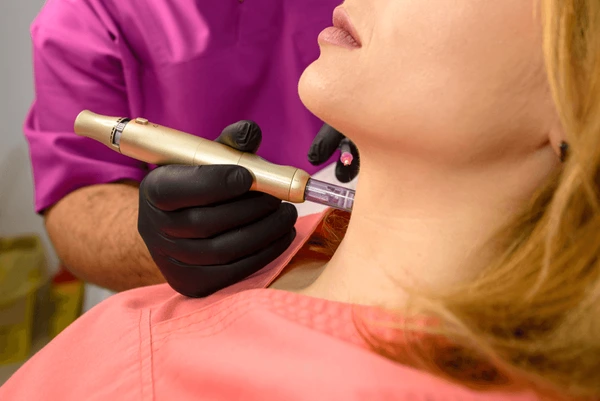 Carbon Laser Treatment in Lucknow